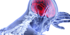 هل التشنج الحراري يؤثر على المخ