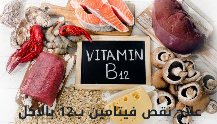 علاج نقص فيتامين ب12 بالاكل
